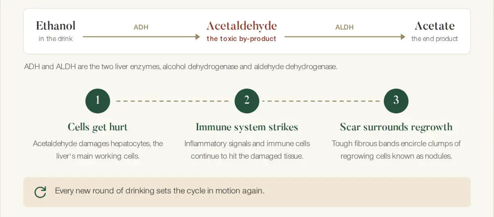 Alcohol stars cirrhosis